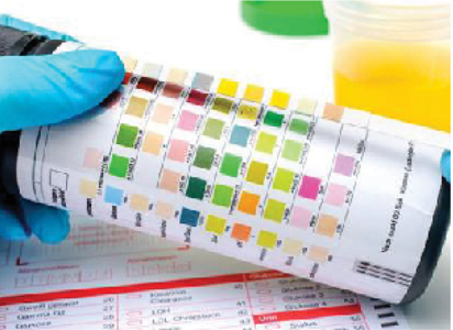 URINE ANALYSIS